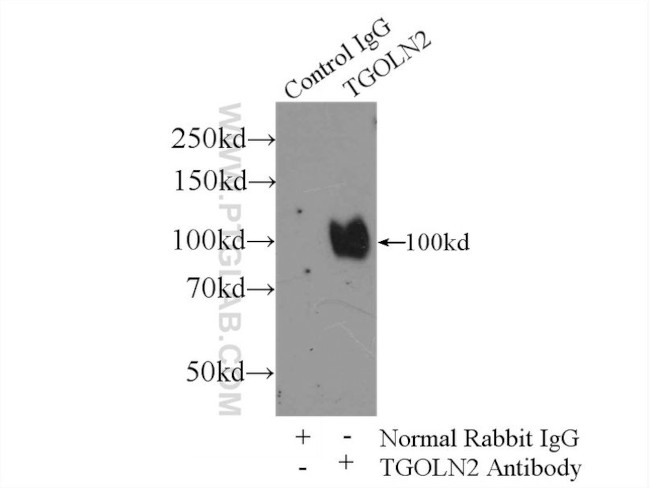 TGN46 Antibody in Immunoprecipitation (IP)