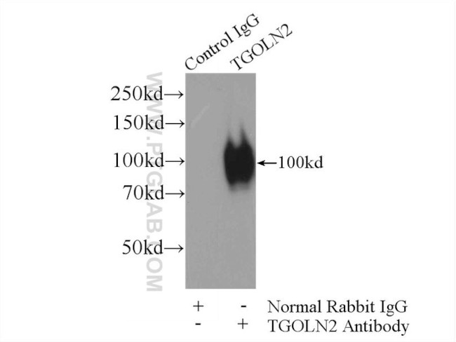 TGN46 Antibody in Immunoprecipitation (IP)
