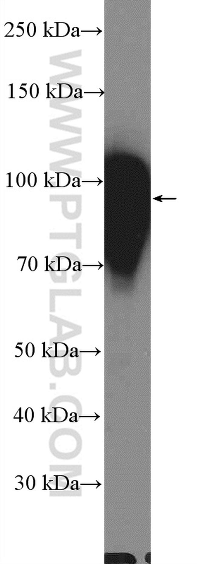 TGN46 Antibody in Western Blot (WB)