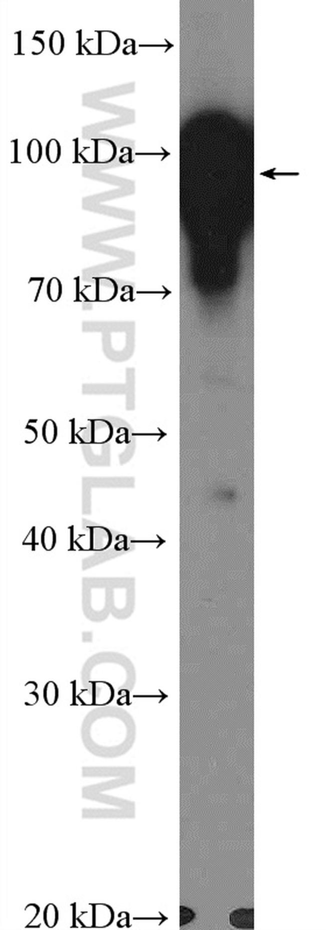 TGN46 Antibody in Western Blot (WB)