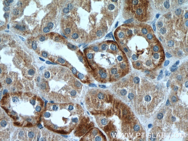 RILP Antibody in Immunohistochemistry (Paraffin) (IHC (P))