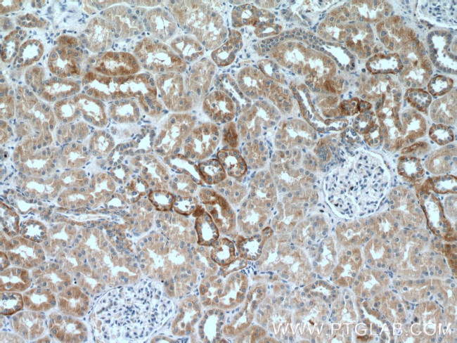 RILP Antibody in Immunohistochemistry (Paraffin) (IHC (P))