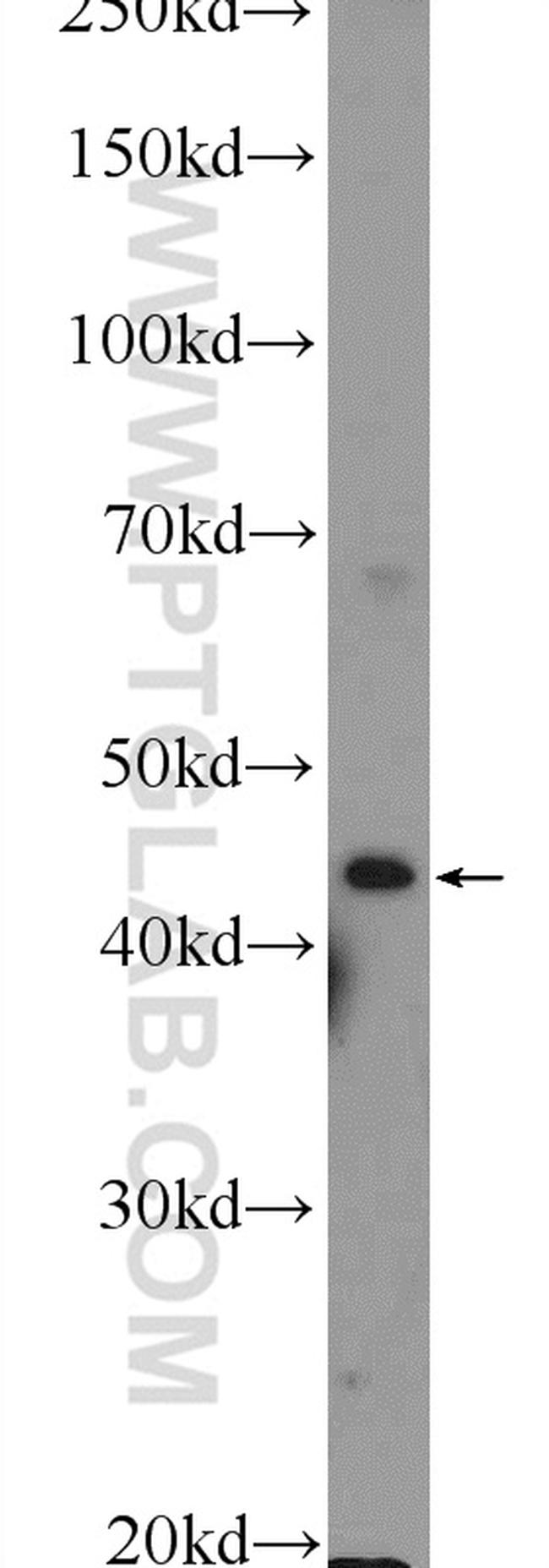 RILP Antibody in Western Blot (WB)