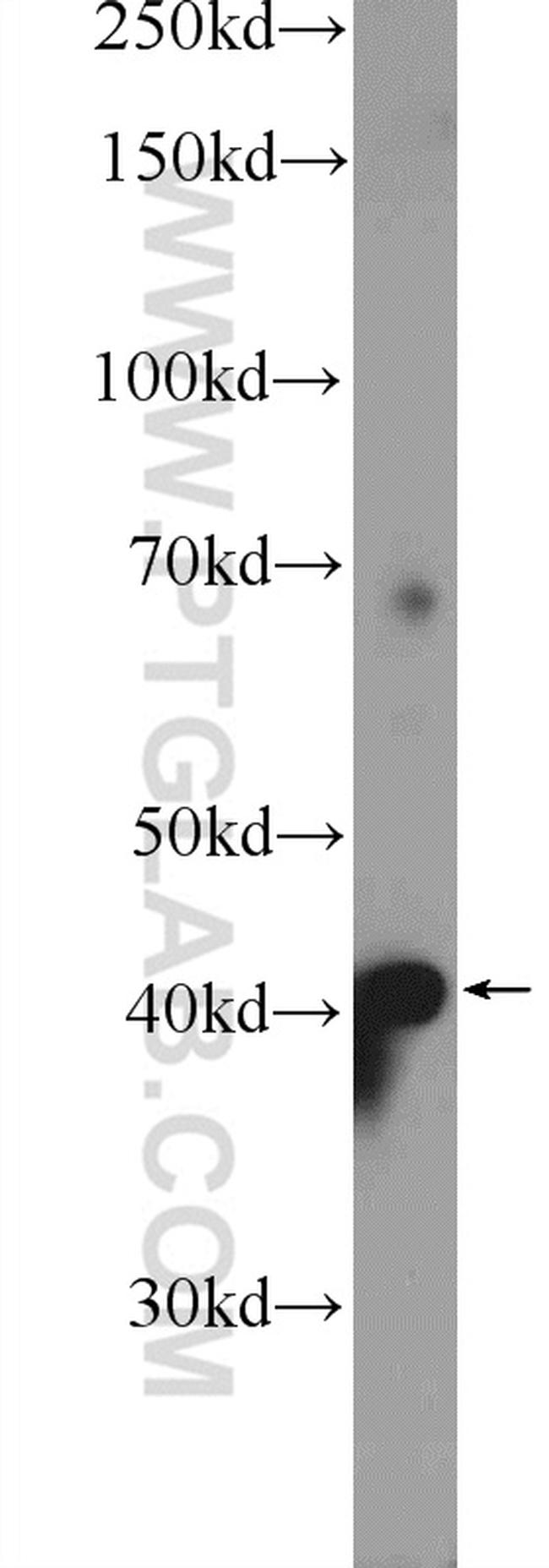 RILP Antibody in Western Blot (WB)