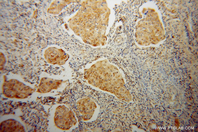 ABCG1 Antibody in Immunohistochemistry (Paraffin) (IHC (P))