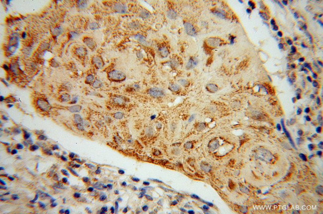 ABCG1 Antibody in Immunohistochemistry (Paraffin) (IHC (P))