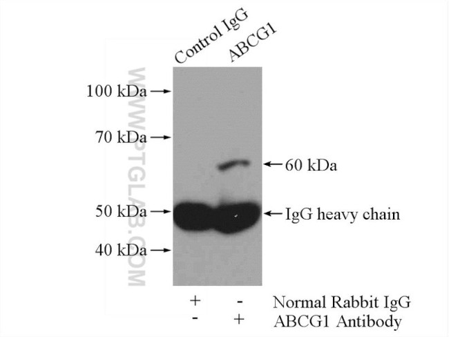 ABCG1 Antibody in Immunoprecipitation (IP)