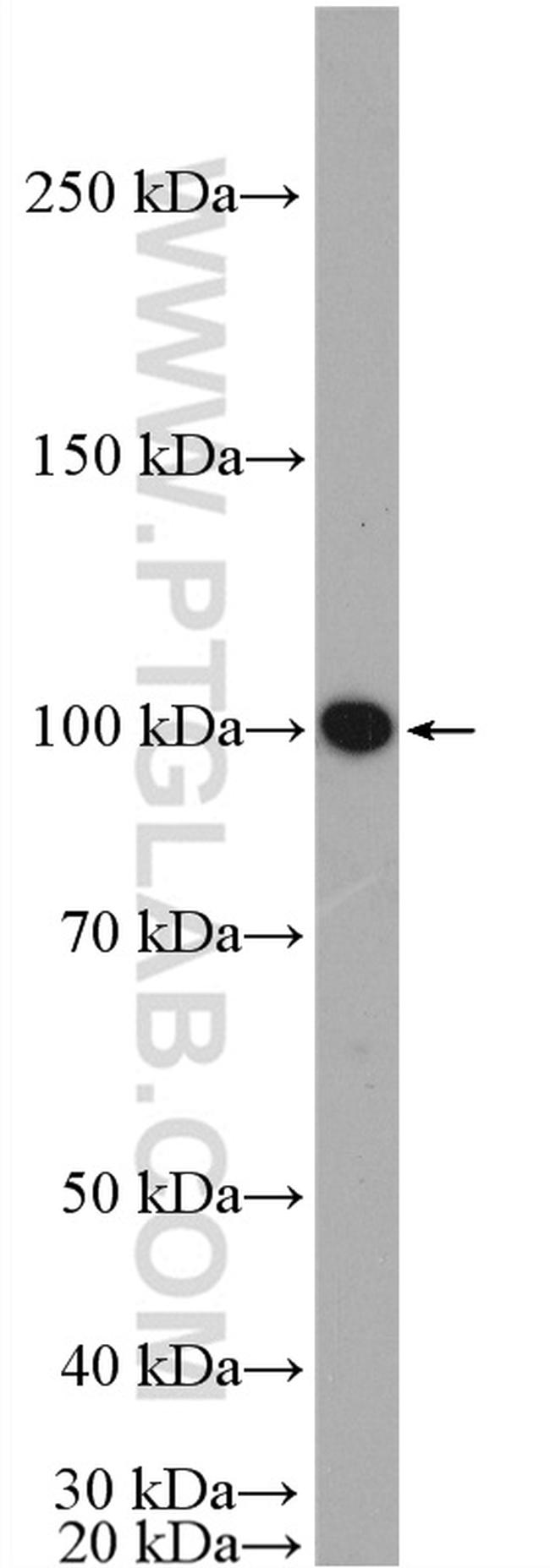 ABCG1 Antibody in Western Blot (WB)