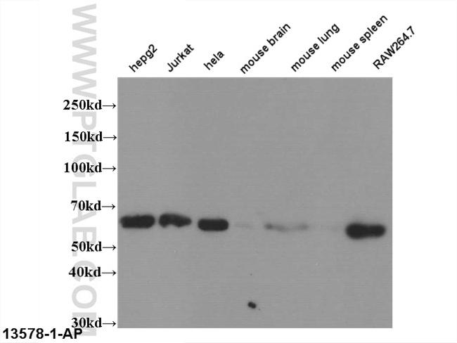 ABCG1 Antibody in Western Blot (WB)