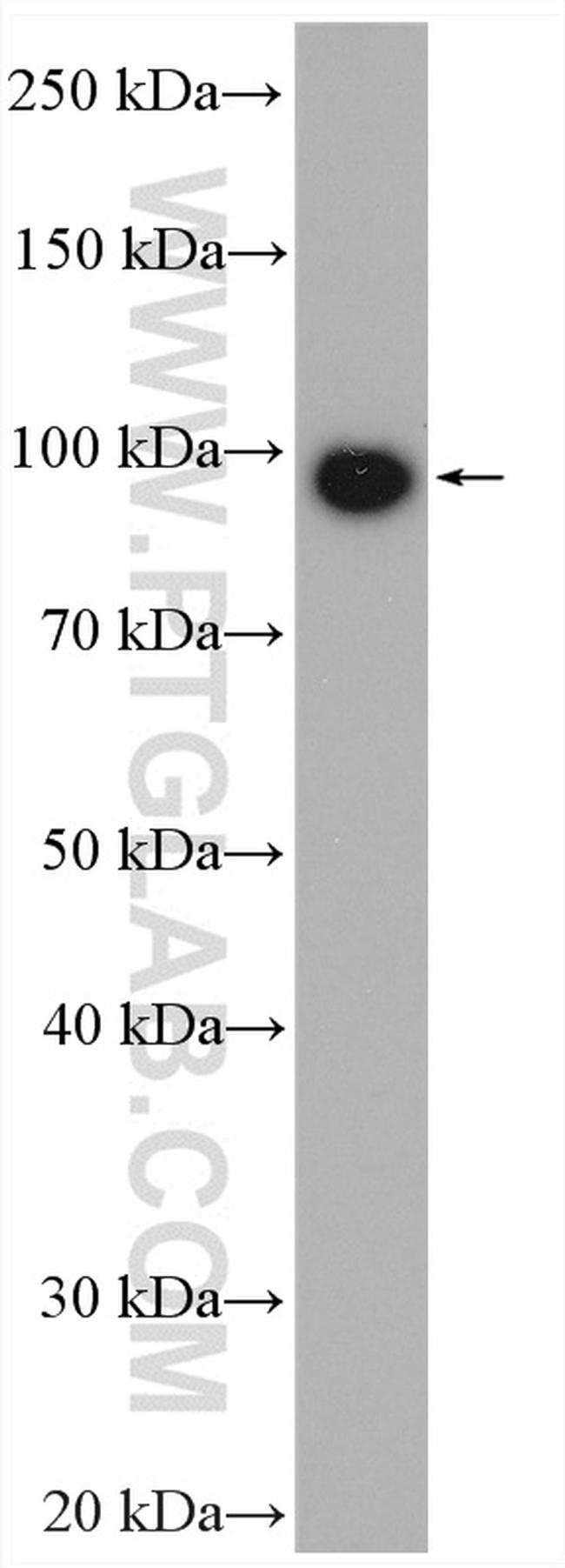 ABCG1 Antibody in Western Blot (WB)