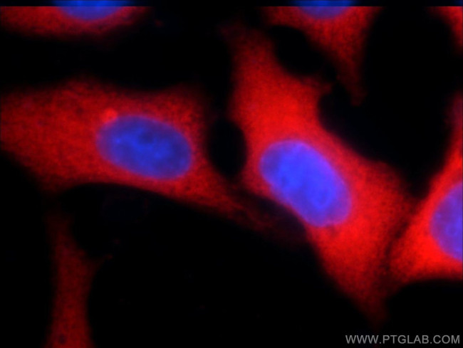 YAP1 Antibody in Immunocytochemistry (ICC/IF)