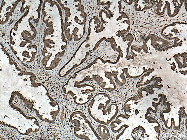 YAP1 Antibody in Immunohistochemistry (Paraffin) (IHC (P))