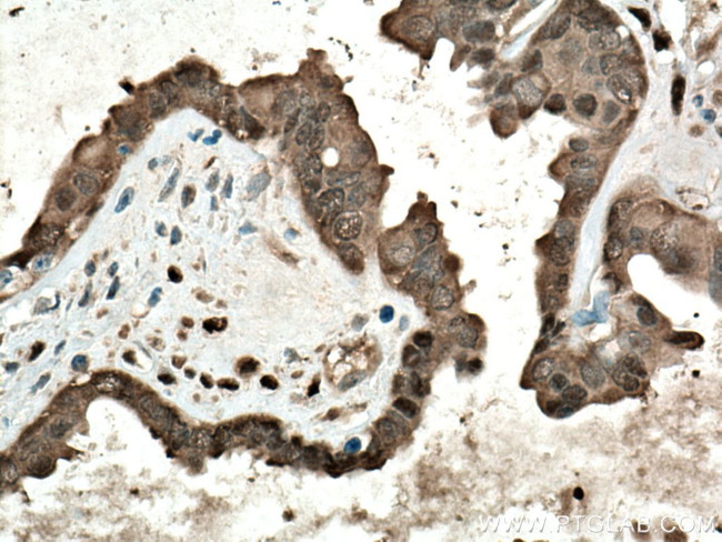 YAP1 Antibody in Immunohistochemistry (Paraffin) (IHC (P))