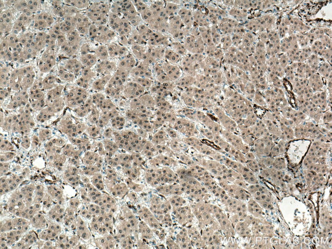 YAP1 Antibody in Immunohistochemistry (Paraffin) (IHC (P))