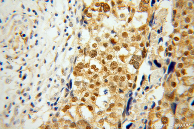 YAP1 Antibody in Immunohistochemistry (Paraffin) (IHC (P))