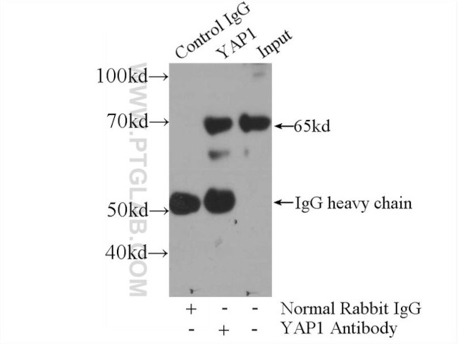 YAP1 Antibody in Immunoprecipitation (IP)