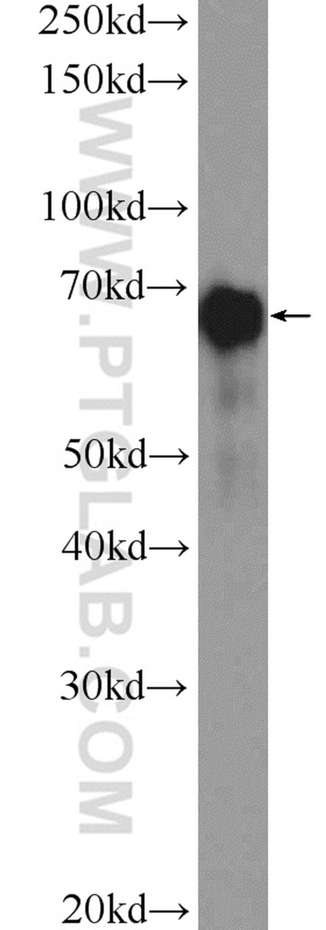 YAP1 Antibody in Western Blot (WB)