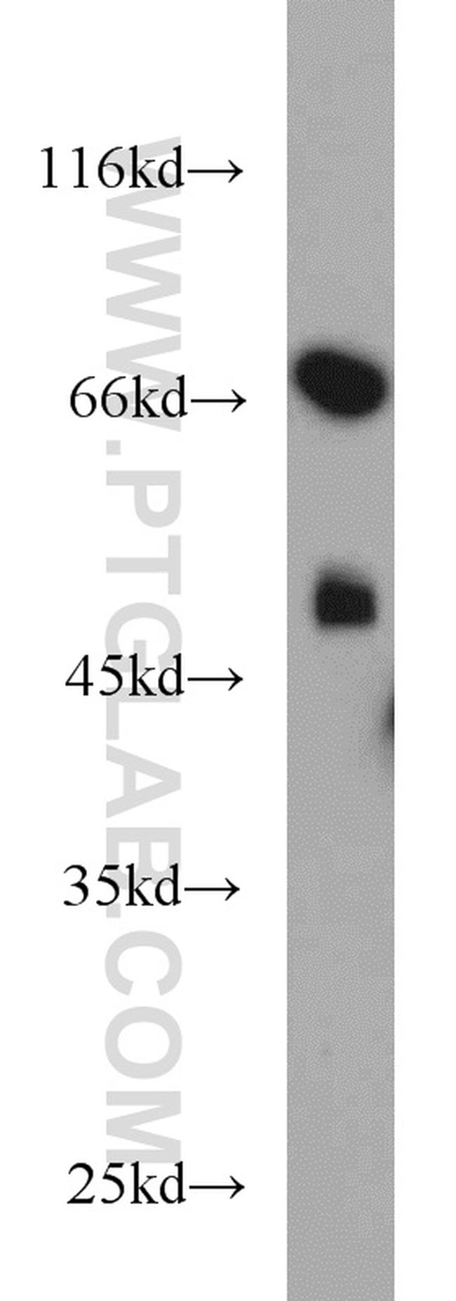 TXNDC3 Antibody in Western Blot (WB)