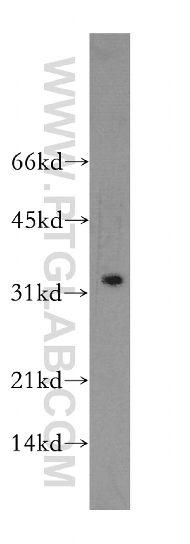GZMB Antibody in Western Blot (WB)