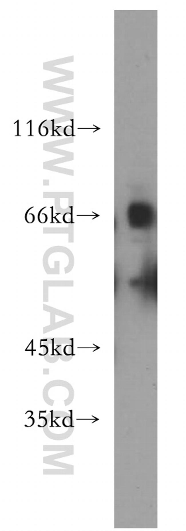 SLC22A2 Antibody in Western Blot (WB)