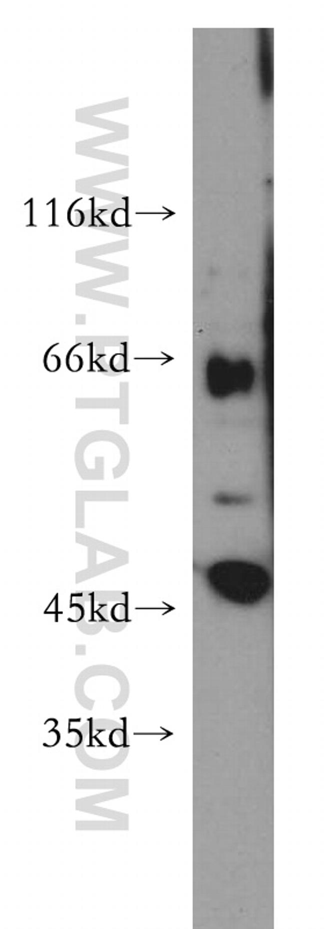 SLC22A2 Antibody in Western Blot (WB)