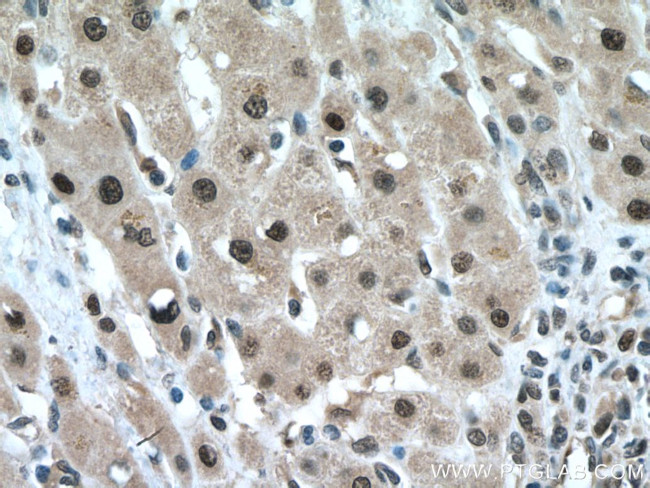 FBXO22 Antibody in Immunohistochemistry (Paraffin) (IHC (P))