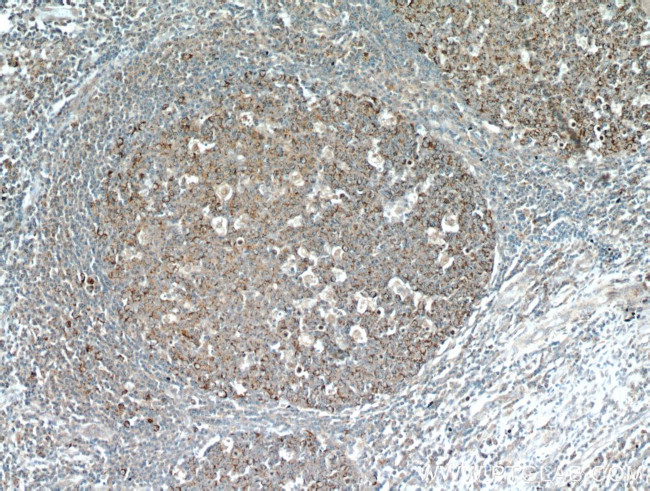 FBXO22 Antibody in Immunohistochemistry (Paraffin) (IHC (P))