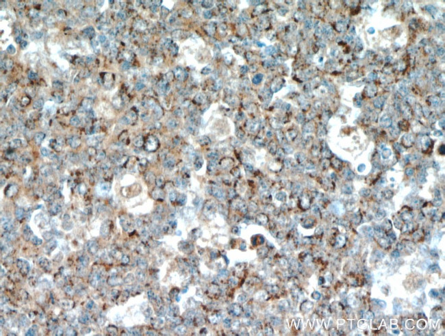 FBXO22 Antibody in Immunohistochemistry (Paraffin) (IHC (P))