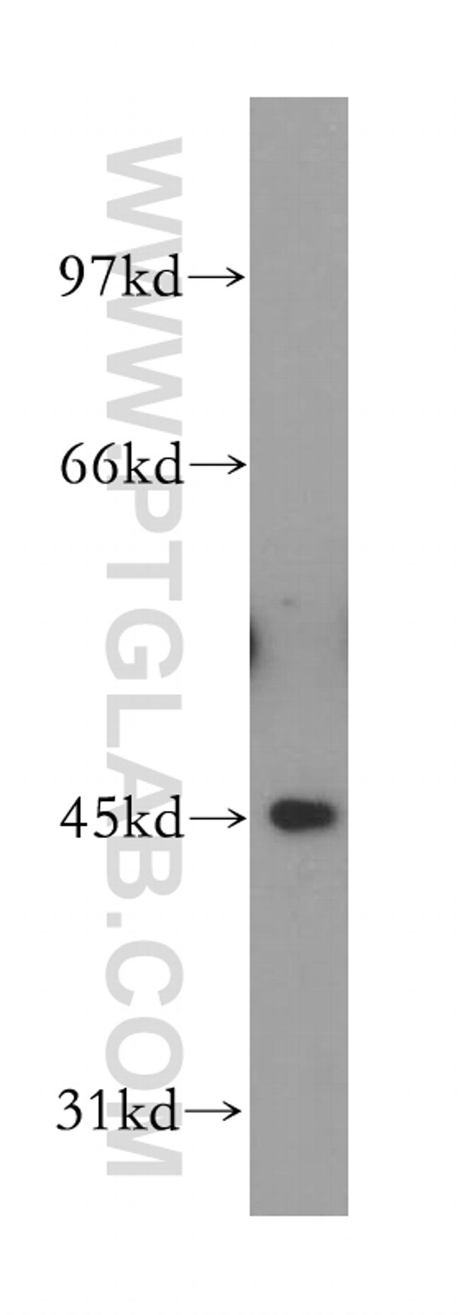 FBXO22 Antibody in Western Blot (WB)