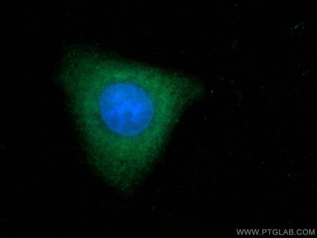 TOB2 Antibody in Immunocytochemistry (ICC/IF)