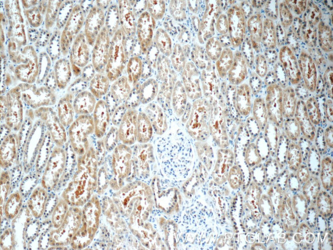 TOB2 Antibody in Immunohistochemistry (Paraffin) (IHC (P))