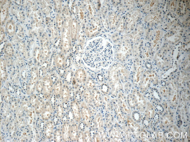 TOB2 Antibody in Immunohistochemistry (Paraffin) (IHC (P))