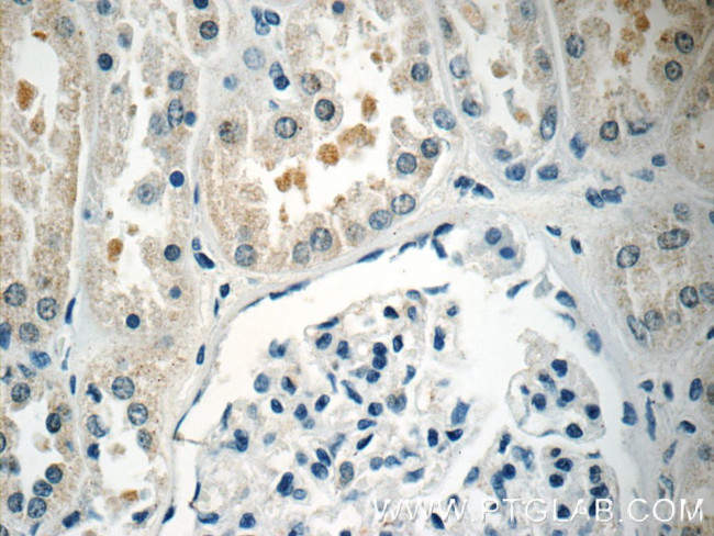 TOB2 Antibody in Immunohistochemistry (Paraffin) (IHC (P))