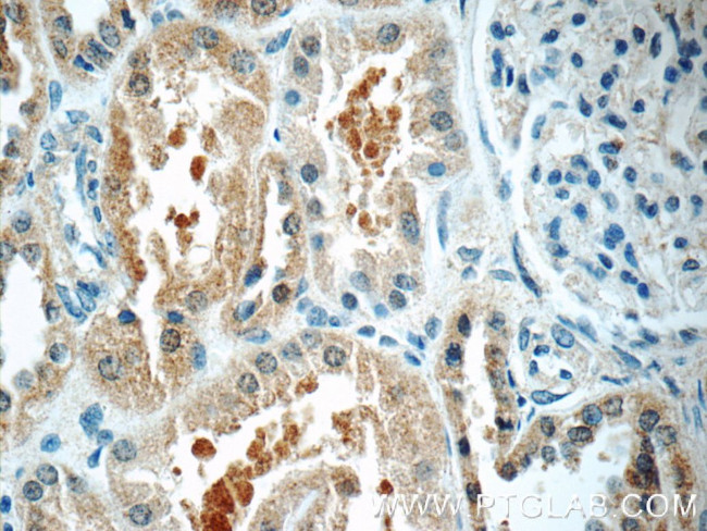 TOB2 Antibody in Immunohistochemistry (Paraffin) (IHC (P))