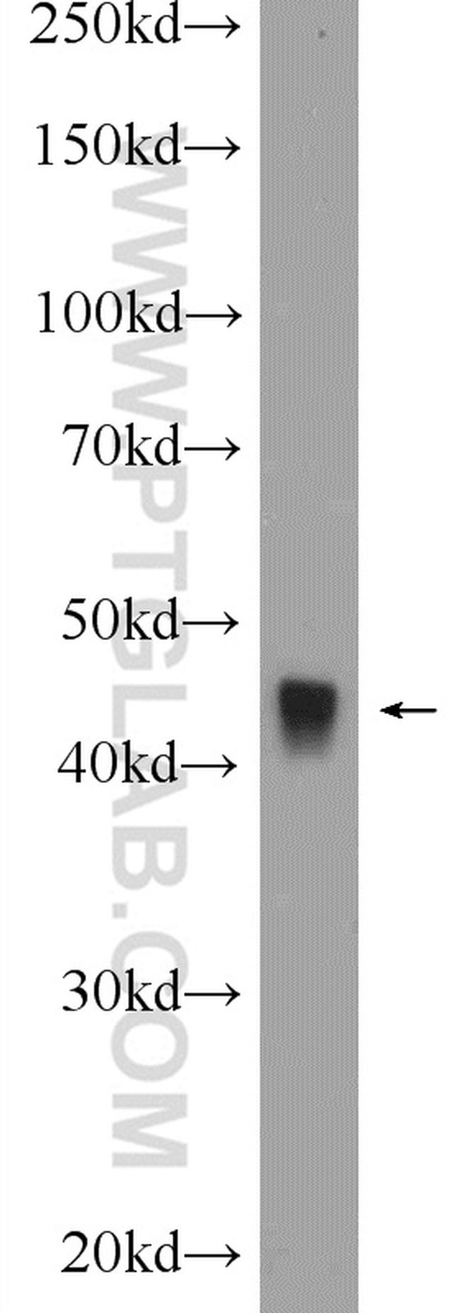 TOB2 Antibody in Western Blot (WB)