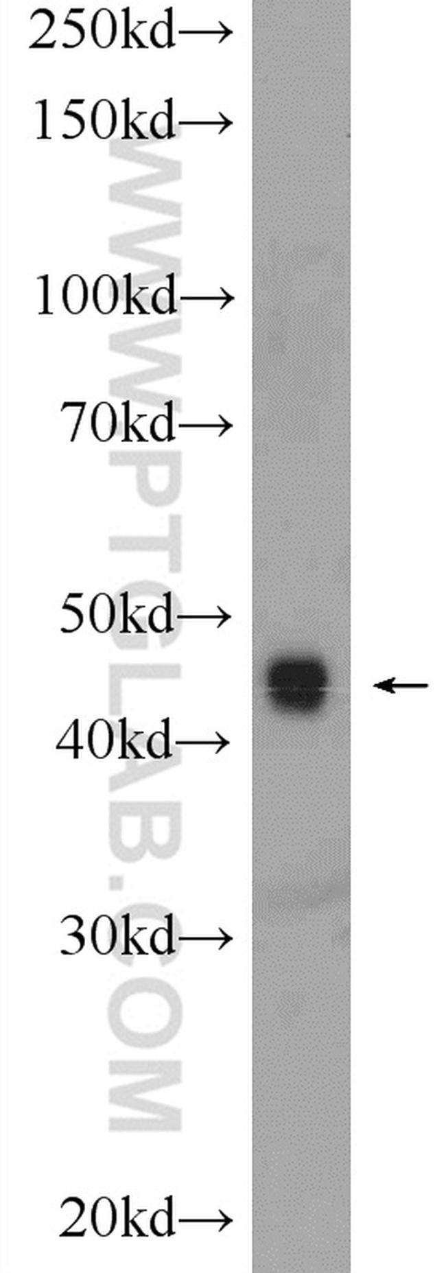 TOB2 Antibody in Western Blot (WB)