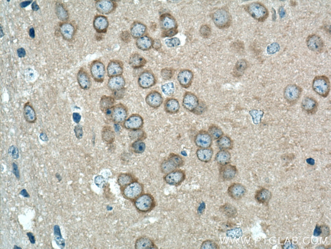 CAMK1D Antibody in Immunohistochemistry (Paraffin) (IHC (P))