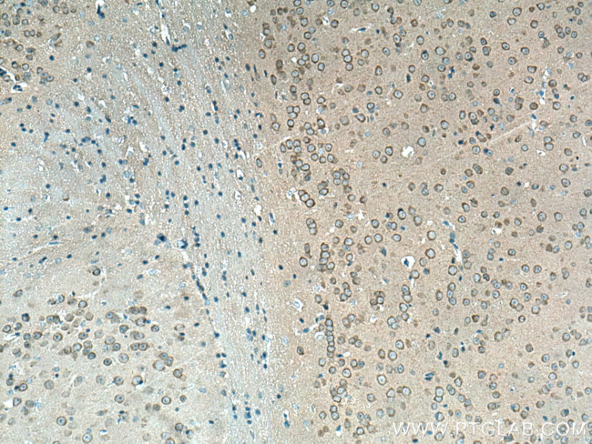 CAMK1D Antibody in Immunohistochemistry (Paraffin) (IHC (P))