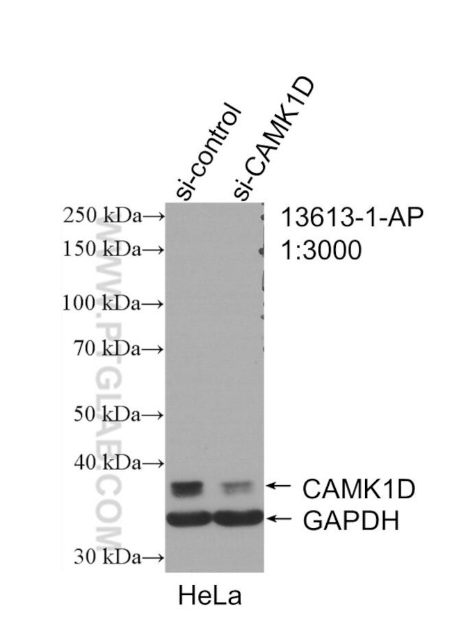 CAMK1D Antibody in Western Blot (WB)