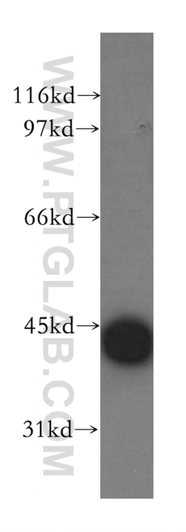 CAMK1D Antibody in Western Blot (WB)