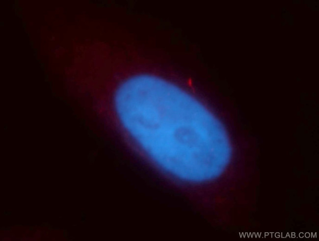 MLXIP Antibody in Immunocytochemistry (ICC/IF)