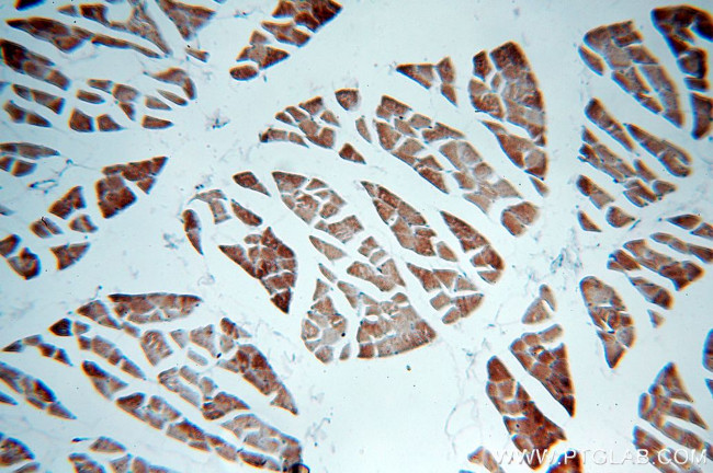 MLXIP Antibody in Immunohistochemistry (Paraffin) (IHC (P))