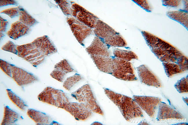 MLXIP Antibody in Immunohistochemistry (Paraffin) (IHC (P))