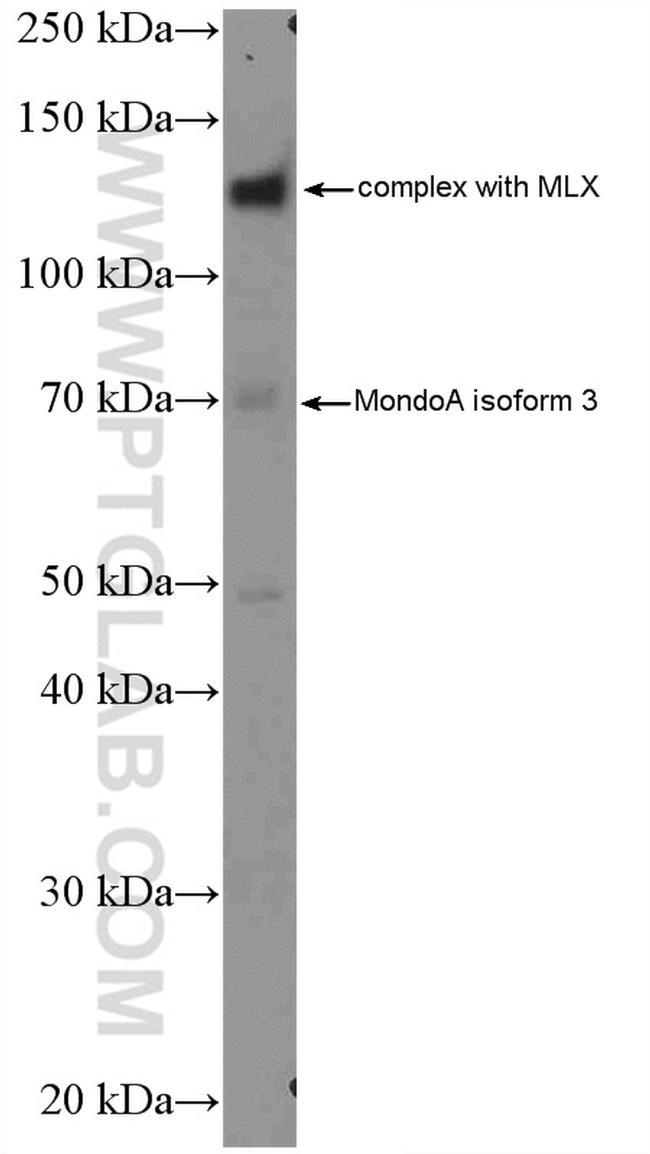 MLXIP Antibody in Western Blot (WB)