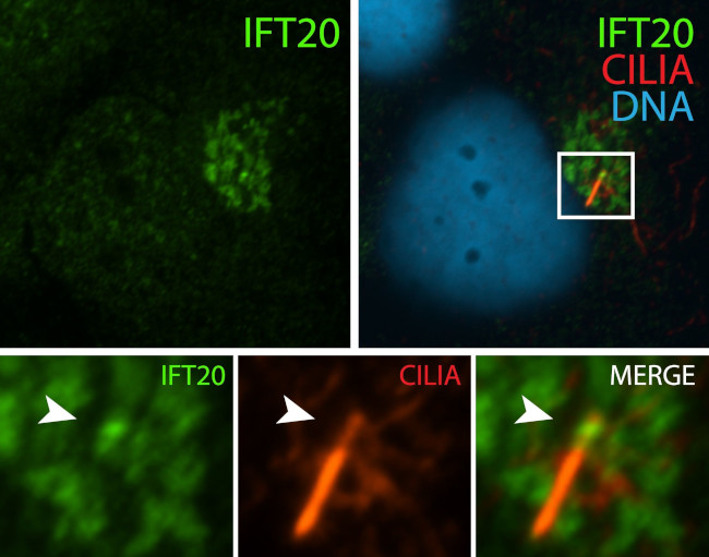 IFT20 Antibody in Immunocytochemistry (ICC/IF)