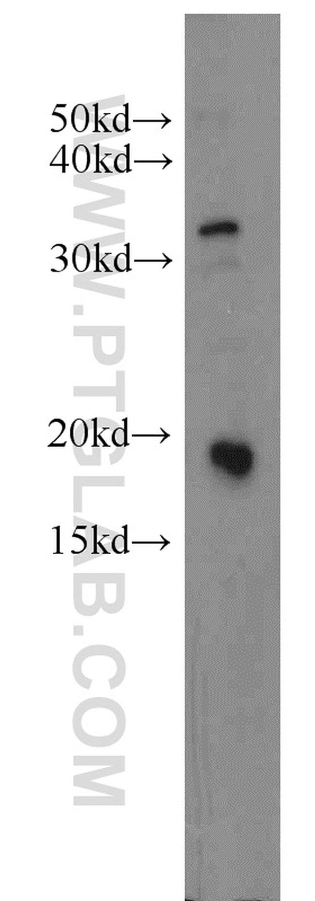 IFT20 Antibody in Western Blot (WB)