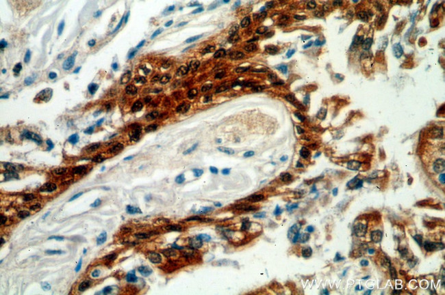 HSPA6 Antibody in Immunohistochemistry (Paraffin) (IHC (P))