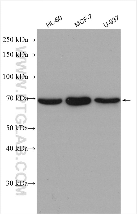 HSPA6 Antibody in Western Blot (WB)