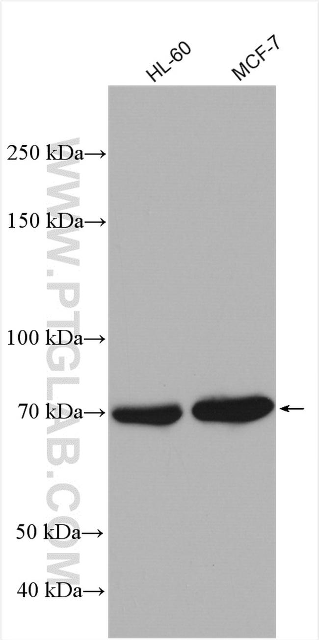 HSPA6 Antibody in Western Blot (WB)