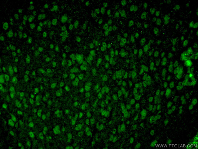 TTL Antibody in Immunohistochemistry (PFA fixed) (IHC (PFA))